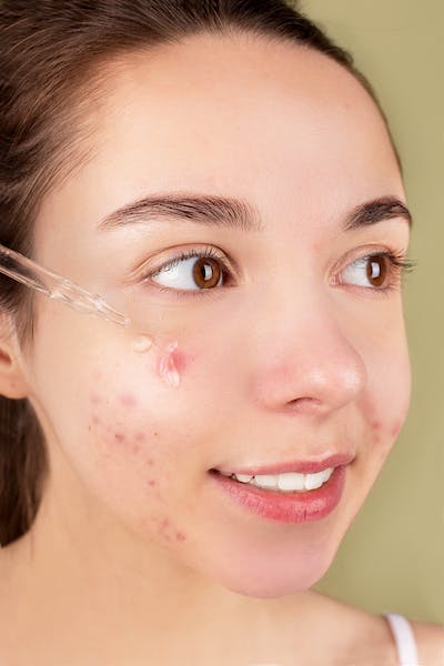 Achieving Clear Skin: The Ultimate Guide to an Effective Acne Facial